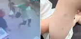 Sevmek istediği sokak köpeğinin saldırısına uğradı! 2 yaşındaki Ozan'ı annesi kurtardı