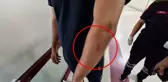 Diyarbakır'da Ambulans Çalışanlarına Saldırı: 2 Yaralı