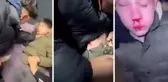 Sağır ve dilsiz çocuğa işkence! Önce dövdüler sonra kulağını kesmeye çalıştılar