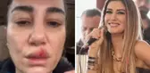 Nadide Sultan temizlik sırasında kaza geçirdi! Kanlar içinde hastaneye gitti