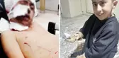 Başıboş köpekler bakkala giden 10 yaşındaki çocuğu parçaladı