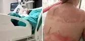Okulda ısınırken aniden kıyafetleri tutuşan küçük kızın vücudunun yarısı yandı