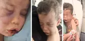 2 yaşındaki bebek annesinin sevgilisi tarafından öldüresiye dövüldü