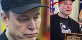 Elon Musk'ın gözündeki morlukla ilgili bomba iddia