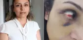 Burcu öğretmenin yardım çığlığı: Kurtarın beni