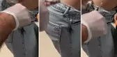 Talihsiz kadının korku dolu anları! Sivilce sandı ama yakından bakınca hastaneye koştu
