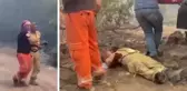 Faciada yaralanan orman görevlisinin feryadı kahretti: Yanıyorum, kurtarın beni