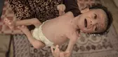 24 saatte 6 kişi daha açlıktan öldü, 7 aylık Salim bebeğin hayatı tehlike altında
