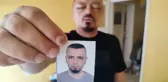 Berberin tavsiyesine uydu, arı sokmasından beter hale geldi