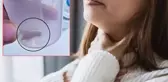 1.5 yıldır süren öksürüğünün nedeni kabak çekirdeğiymiş!
