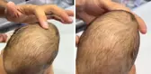 Yeni doğan bebeğin bıngıldağına basan doktorun gördüğü manzara korkunç