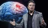 Elon Musk'ın gelecek projesi: Neuralink