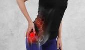 Piriformis sendromu nedir?