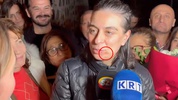 Sinem Dedetaş'ın dudağının kenarındaki kızarıklığın nedeni belli oldu