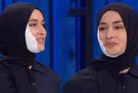 The MasterChef Beyza, whose face was burned, removed the bandage, raising suspicions of a setup.