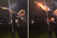 He experienced the shock of his life when the firework he had in his mouth exploded.