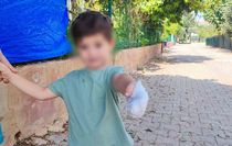 Polis Eskortuyla Hastaneye: 3 Yaşındaki Çocuğun Eli Kurtarıldı
