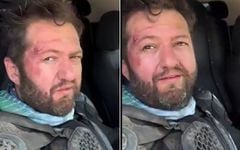 Nalet Bebe virajı alamadı: Yüzü bu hale geldi