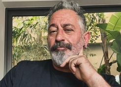 Cem Yılmaz, baston kullanmaya başladı