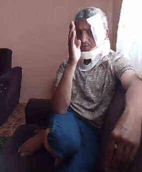 Zabıtalarla tartışıp kendini asmaya çalışan adam: Ne yapayım, hırsızlık mı yapayım?