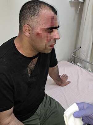 Tatvan Belediye Başkanı ile ilgili usulsüzlük iddialarını gündeme getiren gazeteci Sinan Aygül tekme tokat dövüldü