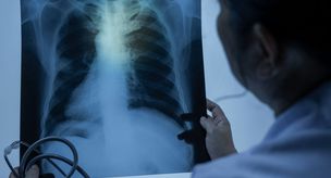 Unmaintained air conditioners and dried laundry can cause permanent damage to the lungs.