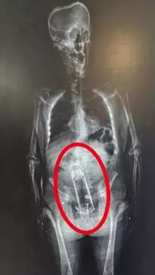 Hapishane girişindeki X-ray taramasından alınan görüntüleri temsil eden fotoğraf