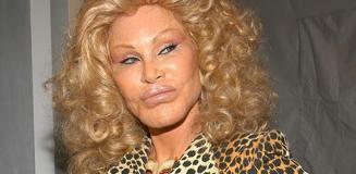 'Kedi Kadın' lakaplı Jocelyn Wildenstein hayatını kaybetti