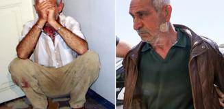 Özgür Özel'e yumruk atan saldırganın kızından CHP'ye geçmiş olsun telefonu