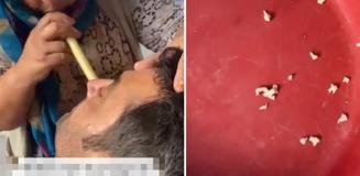 Hindistan değil Adana! Bu saçmalığa inanıp tedavi için gidenler var