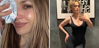 Jennifer Lopez, Amerikan Müzik Ödülleri provaları sırasında yüzünden yaralandı