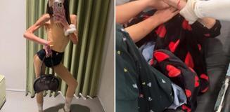 Nihal Candan'ın hastane odasından fotoğrafı ortaya çıktı: 29 kiloya düşmüş