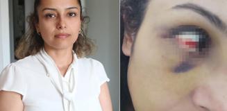 Burcu öğretmenin yardım çığlığı: Kurtarın beni