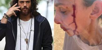 Can Yaman'ın sevgilisi Sara Bluma şiddet gördüğünü açıkladı