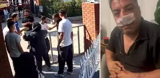 Turistlerden 4 fotoğraf için servet istediler, kavgada araya giren şoförün burnunu kırdılar