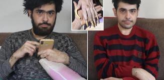 Telefon bağımlısı gençten ailelere tavsiye: Küçükken çocuklara telefon vermeyin