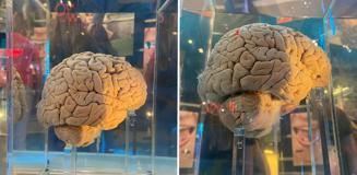 Amsterdam'daki dev arşiv: 5 bin 300 beyin yapay zeka ile haritalanacak Amsterdam'daki dev arşiv: 5 bin 300 beyin yapay zeka ile haritalanacak