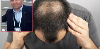 Saç ekimi sırasında fenalaştı, hayatını kaybetti Saç ekimi sırasında fenalaştı, hayatını kaybetti