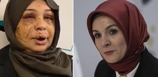 Bakan Göktaş: Şiddete uğrayan kardeşimizin yanındayız, davaya müdahil olacağız