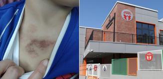 Kreşte taciz soruşturmasında mağdur çocuğun ifadesi: Arkadaşımı dövdü, elbisemi indirip çıplakken kameraya çekti Kreşte taciz soruşturmasında mağdur çocuğun ifadesi: Arkadaşımı dövdü, elbisemi indirip çıplakken kameraya çekti