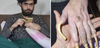 Türkiye'nin konuştuğu Barış'ın yeni işini ve son halini görenler şaşıp kalıyor
