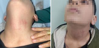 Küçükçekmece'de kadın memurun 10 yaşındaki öğrenciyi okulda darbettiği iddiası
