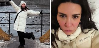 Ünlü şarkıcı Fatma Turgut'un yüzü soğuktan bu hale geldi Ünlü şarkıcı Fatma Turgut'un yüzü soğuktan bu hale geldi