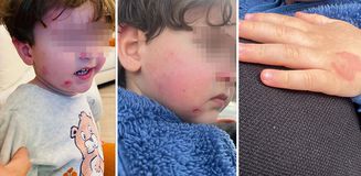 Kreşe bıraktığı çocuğunu darp edilmiş halde aldı Kreşe bıraktığı çocuğunu darp edilmiş halde aldı