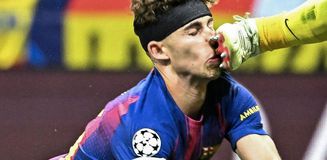 Atletico Madrid-Barcelona maçında yürekleri ağza getiren sakatlık Atletico Madrid-Barcelona maçında yürekleri ağza getiren sakatlık