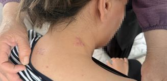 Eşinin saldırdığı kadın 17 bıçak darbesi aldı, ölü numarasıyla kurtuldu