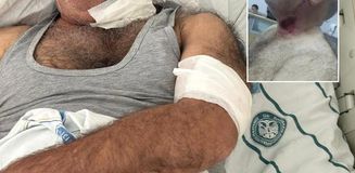 Severek beslediği hayvan bu hale getirdi