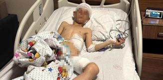 Van'daki köpek dehşetinde kan donduran detaylar