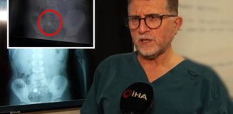 Şeker sanıp yuttu, pil olduğu filmde ortaya çıktı: Ölüme kadar götürebiliyor Şeker sanıp yuttu, pil olduğu filmde ortaya çıktı: Ölüme kadar götürebiliyor