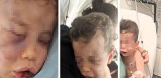 2 yaşındaki bebek annesinin sevgilisi tarafından öldüresiye dövüldü